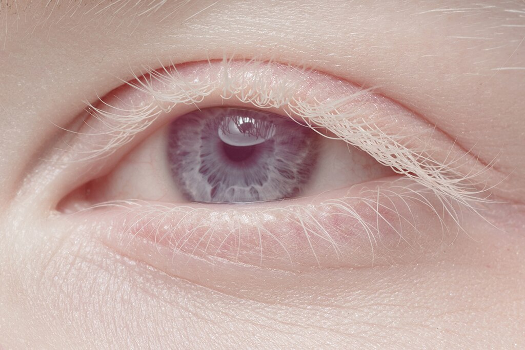 Lila Augen